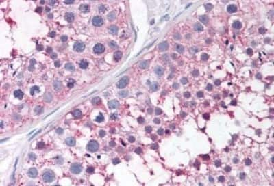 Immunohistochemistry-Paraffin: Prostaglandin E Synthase Antibody [NBP3-14451]